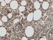 H00006879-M01 - TAF7