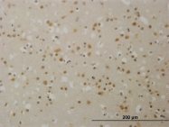H00006907-M07 - TBL1 / TBL1X