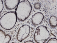 H00006917-M06 - TCEA1 / TFIIS