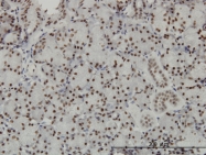 H00006920-M08 - TCEA3 / TFIISH