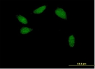 H00006928-B01 - HNF1 beta / TCF2