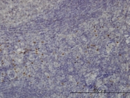 H00006938-M01 - TCF12