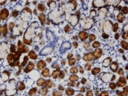 H00006947-M12 - Transcobalamin-1 (TCN1)