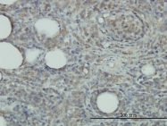 H00007001-M01 - Peroxiredoxin-2 / PRDX2
