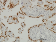 H00007020-M01 - TFAP2A / AP-2 alpha
