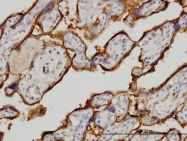 H00007037-M01 - CD71 / TFRC