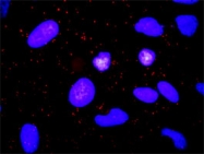 H00007039-D01P - TGF-alpha (TGFA)