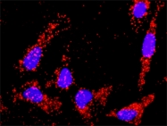 H00007042-D01P - TGF-beta-2 (TGFB2)
