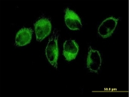H00007057-B01P - Thrombospondin-1 (THBS1)
