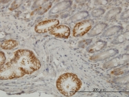 H00007094-M03 - Talin-1 (TLN1)