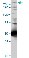 H00007094-M05 - Talin-1 (TLN1)