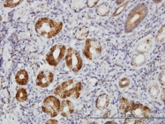 H00007094-M05 - Talin-1 (TLN1)