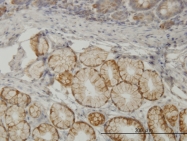 H00007094-M06 - Talin-1 (TLN1)