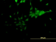 H00007101-M06 - NR2E1