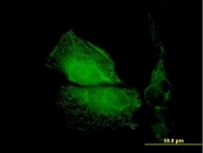 H00007111-B01P - Tropomodulin-1 (TMOD1)