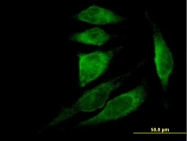 H00007114-B01P - Thymosin beta-4