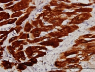 H00007134-M01 - Cardiac Troponin C