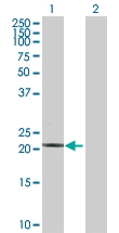 H00007136-D01P - Fast skeletal muscle Troponin I