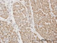 H00007137-M04 - Cardiac Troponin I