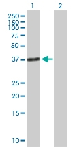 H00007138-B01P - Skeletal muscle Troponin T