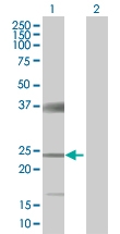 H00007140-B01 - Fast skeletal muscle Troponin T