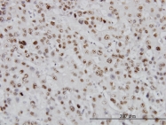 H00007150-M01 - TOP1 / SCL-70