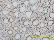 H00007150-M01 - TOP1 / SCL-70