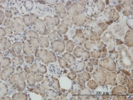 H00007157-M01 - TP53 / p53