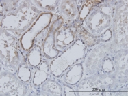 H00007157-M04 - TP53 / p53