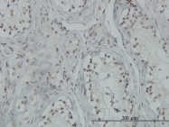 H00007159-M01 - TP53BP2