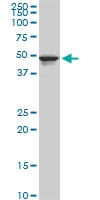 H00007162-M09 - Trophoblast glycoprotein (TPBG)