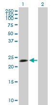 H00007164-B02P - Tumor protein D53 (TPD52L1)
