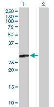 H00007165-B01P - Tumor protein D54 (TPD52L2)