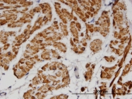 H00007169-M07 - Tropomyosin-2 (TPM2)
