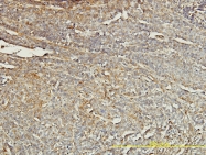 H00007171-M01 - Tropomyosin-4 (TPM4)