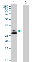 H00007177-B01 - Tryptase beta-1 (TPSAB1)