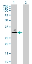 H00007177-B02P - Tryptase beta-1 (TPSAB1)