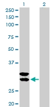 H00007177-D01P - Tryptase beta-1 (TPSAB1)