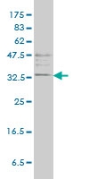 H00007177-M01 - Tryptase beta-1 (TPSAB1)
