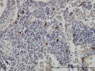 H00007177-M01 - Tryptase beta-1 (TPSAB1)