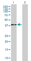 H00007184-B01 - Endoplasmin / HSP90B1 / TRA1