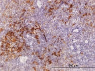 H00007185-B01 - TRAF1 / EBI6