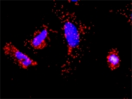 H00007185-M01 - TRAF1 / EBI6