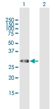 H00007200-B01P - Thyrotropin-releasing hormone (TRH)