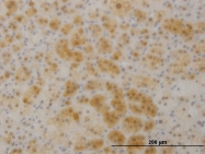 H00007265-M01 - TTC1 / TPR1