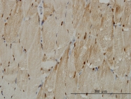 H00007273-M02 - Titin