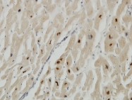 H00007273-M06 - Titin
