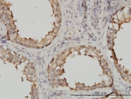 H00007277-M01 - alpha Tubulin / TUBA4A / TUBA1