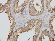 H00007278-M01 - alpha Tubulin / TUBA3C / TUBA2