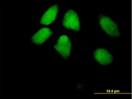 H00007290-B01P - HIRA / TUPLE1